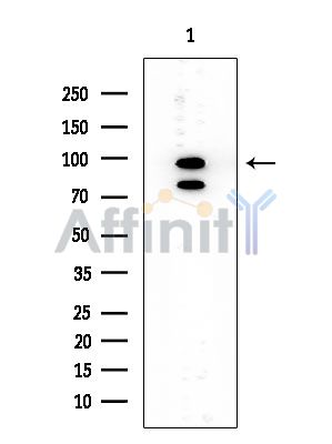 ABCC4 Mouse Monoclonal Antibody - Western blot analysis of extracts from EC304 cells, using ABCC4 Mouse Monoclonal Antibody at 1/1000 dilution.