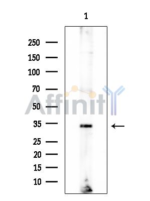 ACP5 Mouse Monoclonal Antibody - Western blot analysis of extracts from EC304 cells, using ACP5 Mouse Monoclonal Antibody at 1/1000 dilution.