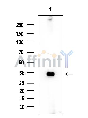 ACP5 Mouse Monoclonal Antibody - Western blot analysis of extracts from Mouse liver, using ACP5 Mouse Monoclonal Antibody at 1/1000 dilution.