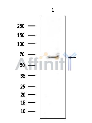 ATIC Mouse Monoclonal Antibody - Western blot analysis of extracts from HUVEC cells, using ATIC Mouse Monoclonal Antibody at 1/1000 dilution.