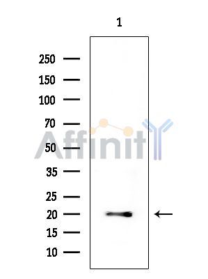 ASF1B Mouse Monoclonal Antibody - Western blot analysis of extracts from EC304 cells, using ASF1B Mouse Monoclonal Antibody at 1/1000 dilution.