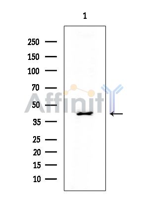 CACNG8 Mouse Monoclonal Antibody - Western blot analysis of extracts from Rat testis, using CACNG8 Mouse Monoclonal Antibody at 1/1000 dilution.