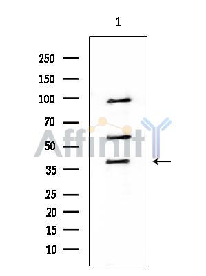 CACNG8 Mouse Monoclonal Antibody - Western blot analysis of extracts from HUVEC cells, using CACNG8 Mouse Monoclonal Antibody at 1/1000 dilution.