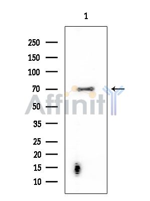 ENaC gamma Mouse Monoclonal Antibody - Western blot analysis of extracts from EC304 cells, using ENaC gamma Mouse Monoclonal Antibody at 1/1000 dilution.