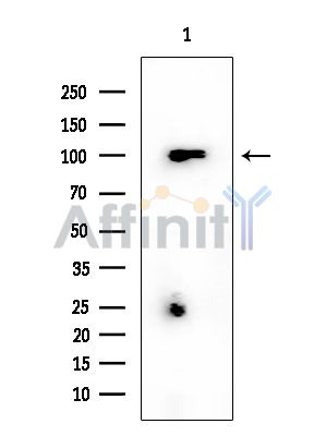 CDH26 Mouse Monoclonal Antibody - Western blot analysis of extracts from EC304 cells, using CDH26 Mouse Monoclonal Antibody at 1/1000 dilution.