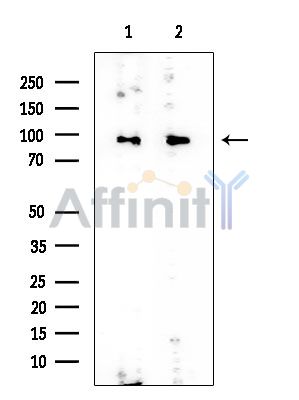 PSMD2 Mouse Monoclonal Antibody - Western blot analysis of extracts from various samples, using PSMD2 Mouse Monoclonal Antibody at 1/1000 dilution.