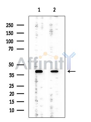 CKII alpha Mouse Monoclonal Antibody - Western blot analysis of extracts from various samples, using CKII alpha Mouse Monoclonal Antibody at 1/1000 dilution.