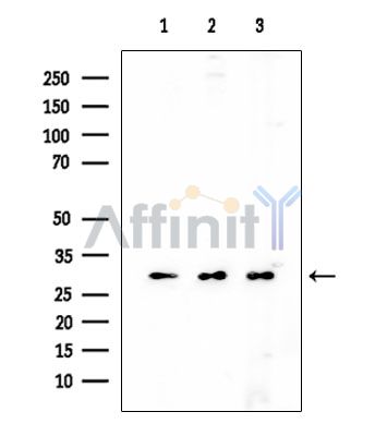 Ribosomal Protein S2 Mouse Monoclonal Antibody - Western blot analysis of extracts from various samples, using Ribosomal Protein S2 Mouse Monoclonal Antibody at 1/1000 dilution.