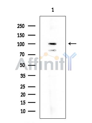 ADAM12 Mouse Monoclonal Antibody - Western blot analysis of extracts from HUVEC cells, using ADAM12 Mouse Monoclonal Antibody at 1/1000 dilution.