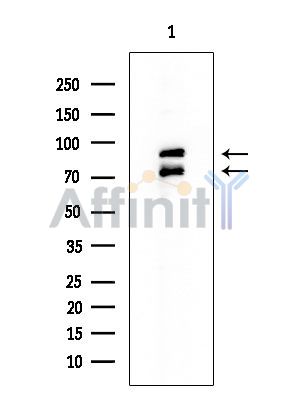 ADAM12 Mouse Monoclonal Antibody - Western blot analysis of extracts from EC304 cells, using ADAM12 Mouse Monoclonal Antibody at 1/1000 dilution.