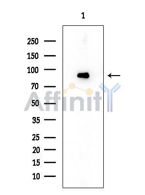 CDH19 Mouse Monoclonal Antibody - Western blot analysis of extracts from EC304 cells, using CDH19 Mouse Monoclonal Antibody at 1/1000 dilution.