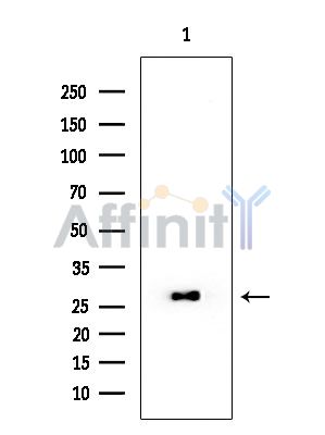 Rim4 Mouse Monoclonal Antibody - Western blot analysis of extracts from Mouse liver, using Rim4 Mouse Monoclonal Antibody at 1/1000 dilution.