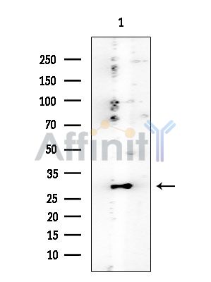 RIT1 Mouse Monoclonal Antibody - Western blot analysis of extracts from HUVEC cells, using RIT1 Mouse Monoclonal Antibody at 1/1000 dilution.
