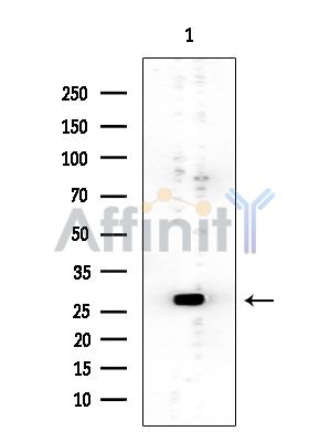 RIT1 Mouse Monoclonal Antibody - Western blot analysis of extracts from EC304 cells, using RIT1 Mouse Monoclonal Antibody at 1/1000 dilution.