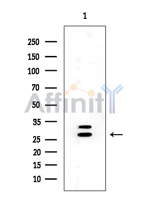 RIT1 Mouse Monoclonal Antibody - Western blot analysis of extracts from Rat testis, using RIT1 Mouse Monoclonal Antibody at 1/1000 dilution.