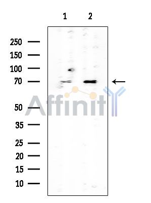 TAF15 Mouse Monoclonal Antibody - Western blot analysis of extracts from various samples, using TAF15 Mouse Monoclonal Antibody at 1/1000 dilution.