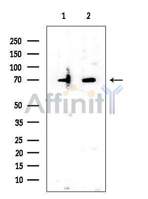 TAF15 Mouse Monoclonal Antibody - Western blot analysis of extracts from various samples, using TAF15 Mouse Monoclonal Antibody at 1/1000 dilution.