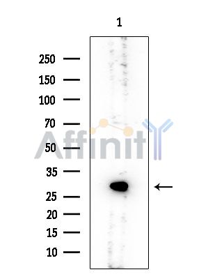 RPS4Y1 Mouse Monoclonal Antibody - Western blot analysis of extracts from COLO205 cells, using RPS4Y1 Mouse Monoclonal Antibody at 1/1000 dilution.