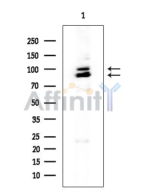CDH18 Mouse Monoclonal Antibody - Western blot analysis of extracts from EC304 cells, using CDH18 Mouse Monoclonal Antibody at 1/1000 dilution.