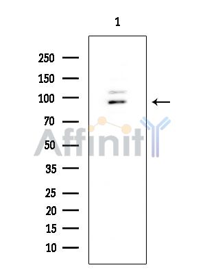 CDH18 Mouse Monoclonal Antibody - Western blot analysis of extracts from HUVEC cells, using CDH18 Mouse Monoclonal Antibody at 1/1000 dilution.