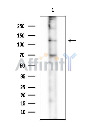SLC9A11 Mouse Monoclonal Antibody - Western blot analysis of extracts from Mouse brain, using SLC9A11 Mouse Monoclonal Antibody at 1/1000 dilution.
