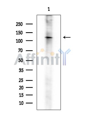 SLC9A11 Mouse Monoclonal Antibody - Western blot analysis of extracts from PC12 cells, using SLC9A11 Mouse Monoclonal Antibody at 1/1000 dilution.