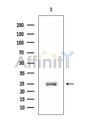 RPL14 Mouse Monoclonal Antibody - Western blot analysis of extracts from Rat testis, using RPL14 Mouse Monoclonal Antibody at 1/1000 dilution.
