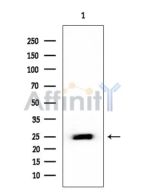 RPL14 Mouse Monoclonal Antibody - Western blot analysis of extracts from EC304 cells, using RPL14 Mouse Monoclonal Antibody at 1/1000 dilution.