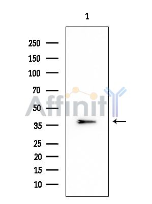 PKA beta Mouse Monoclonal Antibody - Western blot analysis of extracts from HUVEC cells, using PKA beta Mouse Monoclonal Antibody at 1/1000 dilution.