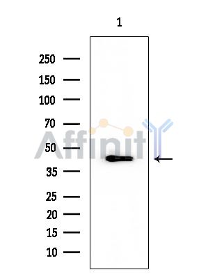 Cytokeratin 18 Mouse Monoclonal Antibody - Western blot analysis of extracts from EC304 cells, using Cytokeratin 18 Mouse Monoclonal Antibody at 1/1000 dilution.
