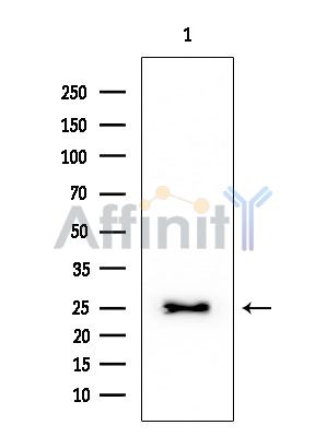 Peroxiredoxin 3 Mouse Monoclonal Antibody - Western blot analysis of extracts from EC304 cells, using Peroxiredoxin 3 Mouse Monoclonal Antibody at 1/1000 dilution.