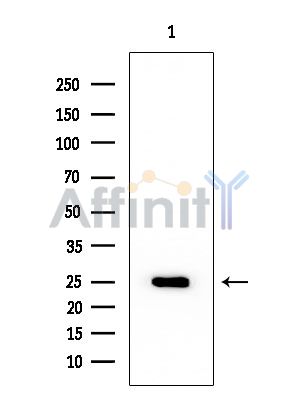Peroxiredoxin 3 Mouse Monoclonal Antibody - Western blot analysis of extracts from Mouse liver, using Peroxiredoxin 3 Mouse Monoclonal Antibody at 1/1000 dilution.