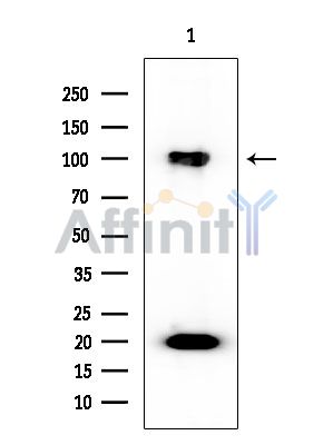 PSMD2 Mouse Monoclonal Antibody - Western blot analysis of extracts from Mouse liver, using PSMD2 Mouse Monoclonal Antibody at 1/1000 dilution.