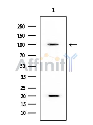 PSMD2 Mouse Monoclonal Antibody - Western blot analysis of extracts from Rat testis, using PSMD2 Mouse Monoclonal Antibody at 1/1000 dilution.