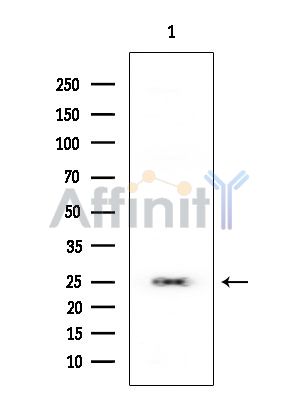 RPL10 Mouse Monoclonal Antibody - Western blot analysis of extracts from Rat testis, using RPL10 Mouse Monoclonal Antibody at 1/1000 dilution.