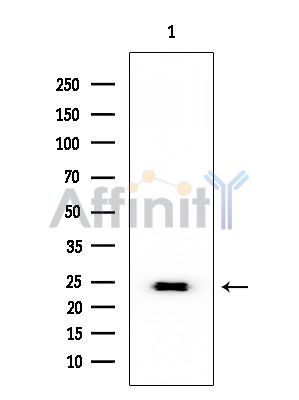 RPL10 Mouse Monoclonal Antibody - Western blot analysis of extracts from Mouse liver, using RPL10 Mouse Monoclonal Antibody at 1/1000 dilution.