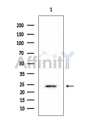 RPL10 Mouse Monoclonal Antibody - Western blot analysis of extracts from HUVEC cells, using RPL10 Mouse Monoclonal Antibody at 1/1000 dilution.