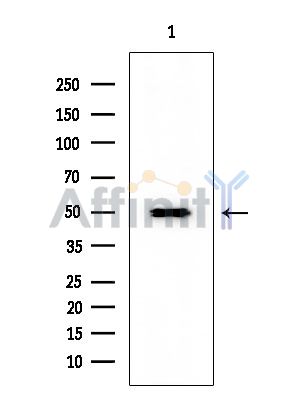 TFDP1 Mouse Monoclonal Antibody - Western blot analysis of extracts from EC304 cells, using TFDP1 Mouse Monoclonal Antibody at 1/1000 dilution.