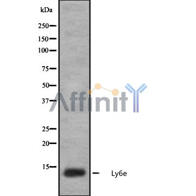 LY6A Antibody - Western blot analysis of A549 whole cell lysates using LY6A Antibody.