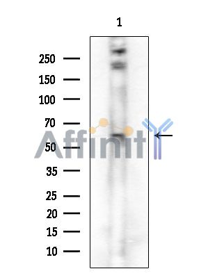 Phospho-Chk2 (Thr68) Antibody - Western blot analysis of extracts from 293 cells(starvation treatment), using Phospho-Chk2 (Thr68) Antibody.