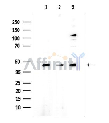 eIF4A3 Mouse Monoclonal Antibody - Western blot analysis of extracts from various samples, using eIF4A3 Mouse Monoclonal Antibody at 1/1000 dilution.