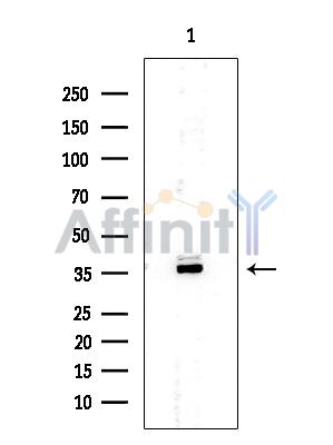 OVOL1 Mouse Monoclonal Antibody - Western blot analysis of extracts from EC304 cells, using OVOL1 Mouse Monoclonal Antibody at 1/1000 dilution.