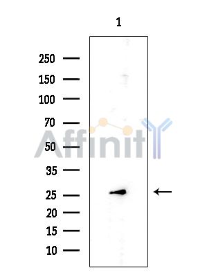 ALR Mouse Monoclonal Antibody - Western blot analysis of extracts from EC304 cells, using ALR Mouse Monoclonal Antibody at 1/1000 dilution.
