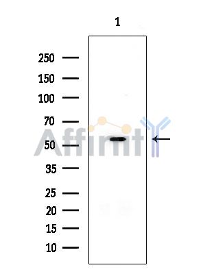 PLCH Mouse Monoclonal Antibody - Western blot analysis of extracts from EC304 cells, using PLCH Mouse Monoclonal Antibody at 1/1000 dilution.