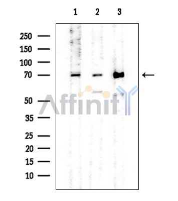ERp72 Mouse Monoclonal Antibody - Western blot analysis of extracts from various samples, using ERp72 Mouse Monoclonal Antibody at 1/1000 dilution.