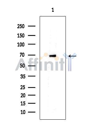 ERp72 Mouse Monoclonal Antibody - Western blot analysis of extracts from EC304 cells, using ERp72 Mouse Monoclonal Antibody at 1/1000 dilution.