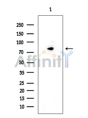 CHRM3 Mouse Monoclonal Antibody - Western blot analysis of extracts from EC304 cells, using CHRM3 Mouse Monoclonal Antibody at 1/1000 dilution.