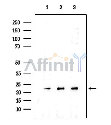 Transgelin 2 Mouse Monoclonal Antibody - Western blot analysis of extracts from various samples, using Transgelin 2 Mouse Monoclonal Antibody at 1/1000 dilution.