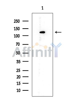 CAPRIN1 Mouse Monoclonal Antibody - Western blot analysis of extracts from EC304 cells, using CAPRIN1 Mouse Monoclonal Antibody at 1/1000 dilution.