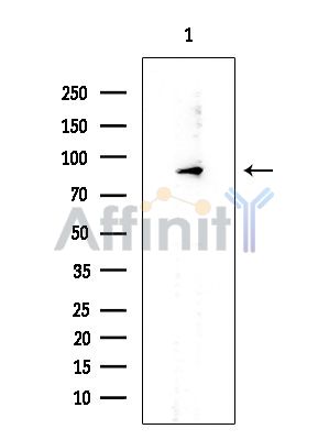 DDX21 Mouse Monoclonal Antibody - Western blot analysis of extracts from EC304 cells, using DDX21 Mouse Monoclonal Antibody at 1/1000 dilution.